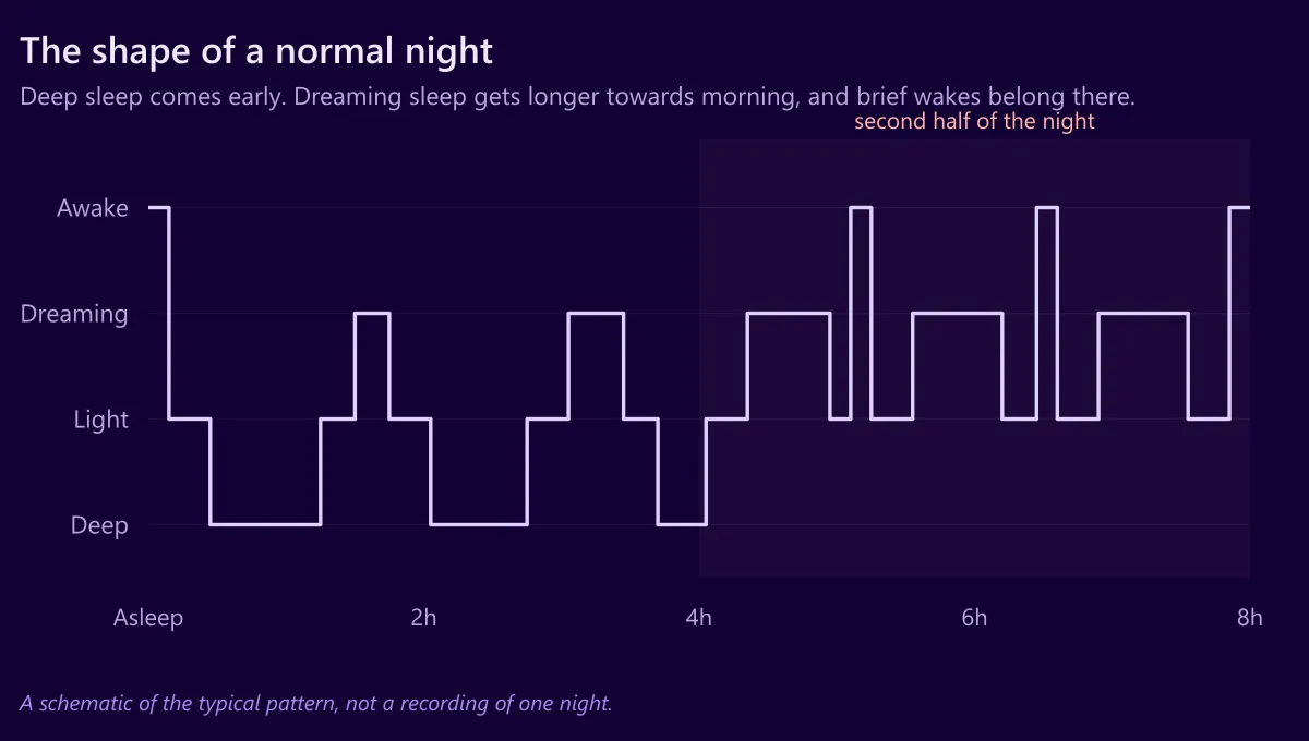 Chart showing the typical shape of a night of sleep: deep sleep early, dreaming sleep lengthening towards morning, and brief wakes in the second half.